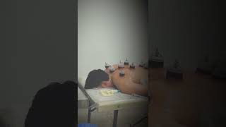 Казань +79600578181 хиджама#казань #массаж #hijama #рукья #massage