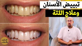 تبييض الأسنان وعلاج مشاكل اللثة وصفات الدكتور عماد ميزاب ميزاب Docteur Imad Mizab