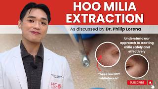 MILIA EXTRACTION: SAFE & EFFECTIVE MILIA REMOVAL BY A DERMATOLOGIST