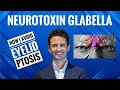 Injectors guide  neurotoxin  glabella