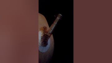 How to insert your Dexcom g5 & how to remove