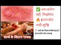 burn remidies #skincare/रतनजोत जलाने के फायदे और सही विधि | Ratanjot Burn Remedy for Home Peace