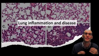 Lung inflammation and disease