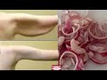 Lose Arm Fat in 3 days with Onion Water - Get rid of Flabby Arms & tone Sagging arms