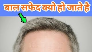 बाल सफेद क्यों हो जाते हैं || ? WHY IS BECOME WHITE HAIR