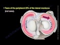 meniscus tear  , knee injury ,lateral meniscus    - Everything You Need To Know - Dr. Nabil Ebraheim