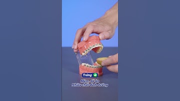 Niềng răng ăn được gì ?| Lạc Việt Intech Niềng Răng #shorts