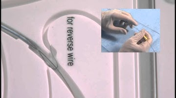 Angioplasty technique: Reverse wire