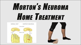 How to Get Rid of Pain from Morton