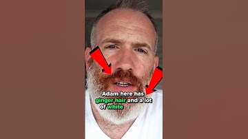 Gingers Who Dye Their Beards Shamelessly: Adam