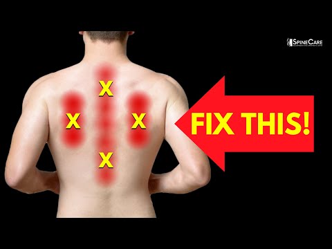 How to Instantly Relieve Nerve Pain in Your Upper Back 