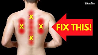 How to Instantly Relieve Nerve Pain in Your Upper Back