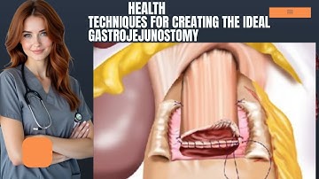 Techniques for Creating the Ideal Gastrojejunostomy