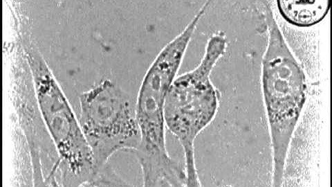 Dividing normal adult rat fibroblasts in tissue cultures / Warren H. Lewis
