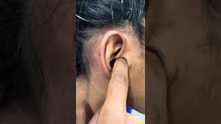 Remedio para la sordera. #sordera  #tips  #salud  #bienestar  #audición