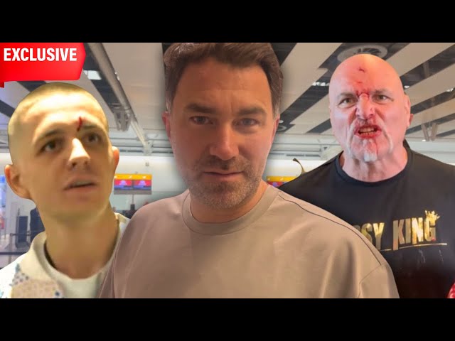 “JOHN FURY SHOULD NOT HAVE DONE IT” Eddie Hearn FIRST REACTION TO HEADBUTT | PREDICTS FURY USYK class=