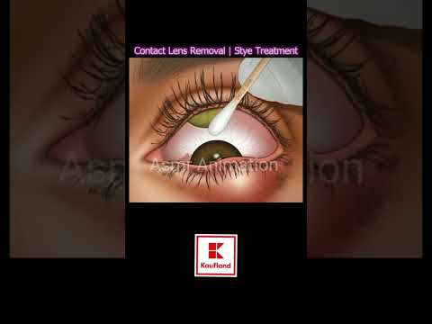 Akhon Me Itna Sara Lens Viral Asmranimation Trending Treatment Shortvideo Subscribe