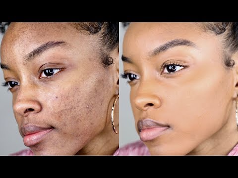 How to cover acne/dark spots WITHOUT a lot of makeup | Slim Reshae