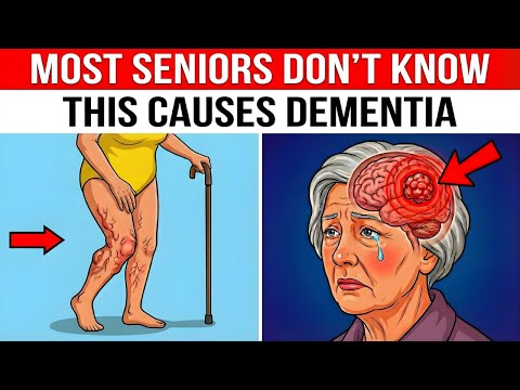 OVER 65: 7 Vascular Dementia Symptoms in Walking (Everyone Ignores #3)