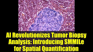AI Revolutionizes Tumor Biopsy Analysis: Introducing SMMILe for Spatial Quantification