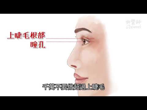 【高雄隆鼻推薦、二次隆鼻推薦】朝天鼻手術方式與治療！