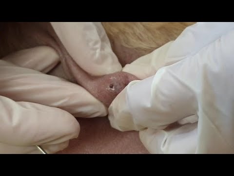 ENORMOUS SEBACEOUS CYST POP on a dog