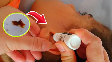 Como age o Cerumin no ouvido?