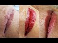 Micropigmentação labial, processo de cicatrização