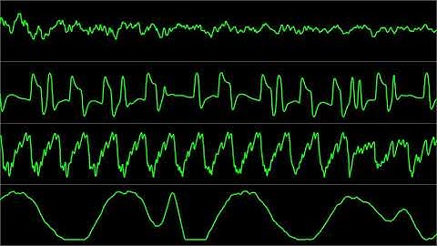 "Lotus III: The Ultimate Challenge" [Amiga] Full Soundtrack (Oscilloscope Visualization)
