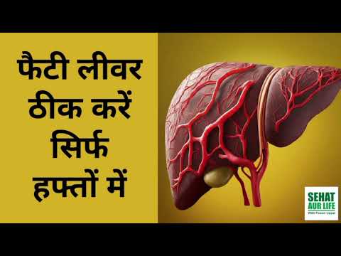 फैटी लीवर ठीक करने का सबसे तेज तरीका, Fastest Way To Cure Fatty Liver