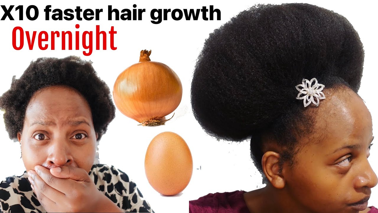 Overnight EGG & Onion for x10 faster hair growth. Ft aloe vera ! It actually works 😱