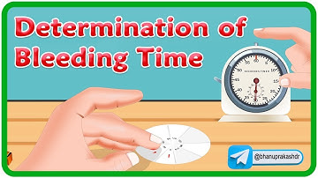 Determination Of Bleeding Time (Duke