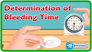 Determination Of Bleeding Time (Duke's Method) Animation : Physiology Practical's