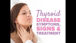 ⁣8 Senyales ng Sakit sa THYROID : Hyper o Hypo-thyroid - Payo ni Doc Willie Ong #469