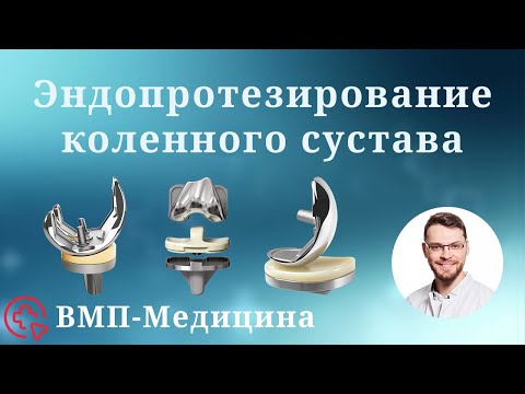 Эндопротезирование коленного сустава | ВМП-Медицина