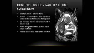 ISMRM MR Academy  MRI in Pregnancy