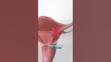 Hoe spiraaltjes werken (3D-animatie)