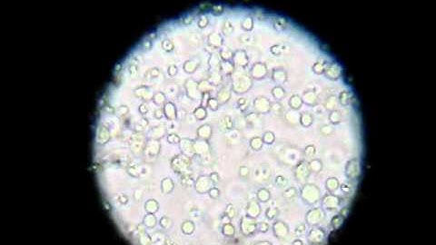 EPD-Day2 Fibronectin coated dish