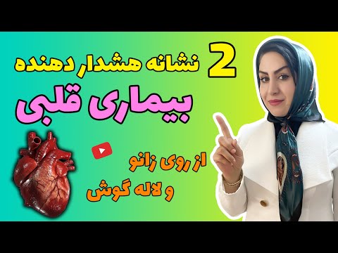 راز تشخیص بیماری قلبی بدون ا کو و نوارقلب بهترین روش درمان با آنژیو طبیعی به روش فرشته اسفیدانی