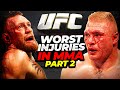 Worst Injuries in MMA - Part 2