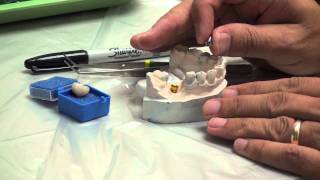 Implant Crown Delivery Part 1