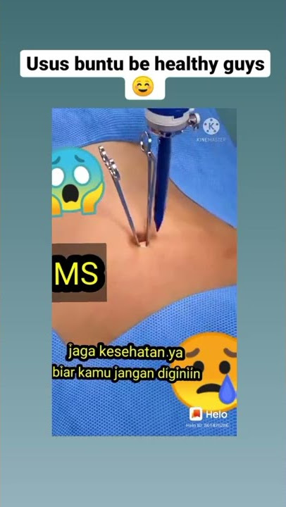part 1 praktek operasi usus  buntu be carefull healthy guys 💚🤍