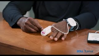 WatchPAT ONE step-by-step guide - Spanish Wealth