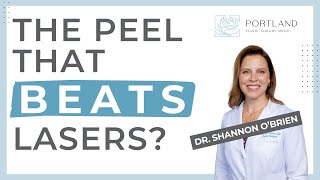 The peel that BEATS lasers?