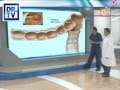 DR TV PERU 17-04-2012 - 3 El Asistente del Día- Colonoscopía