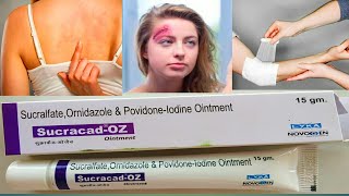 Sucracad OZ ointment in Hindi || ornidazole, povidone iodine uses || बैक्टीरियल इनफेक्शन की दवा ||