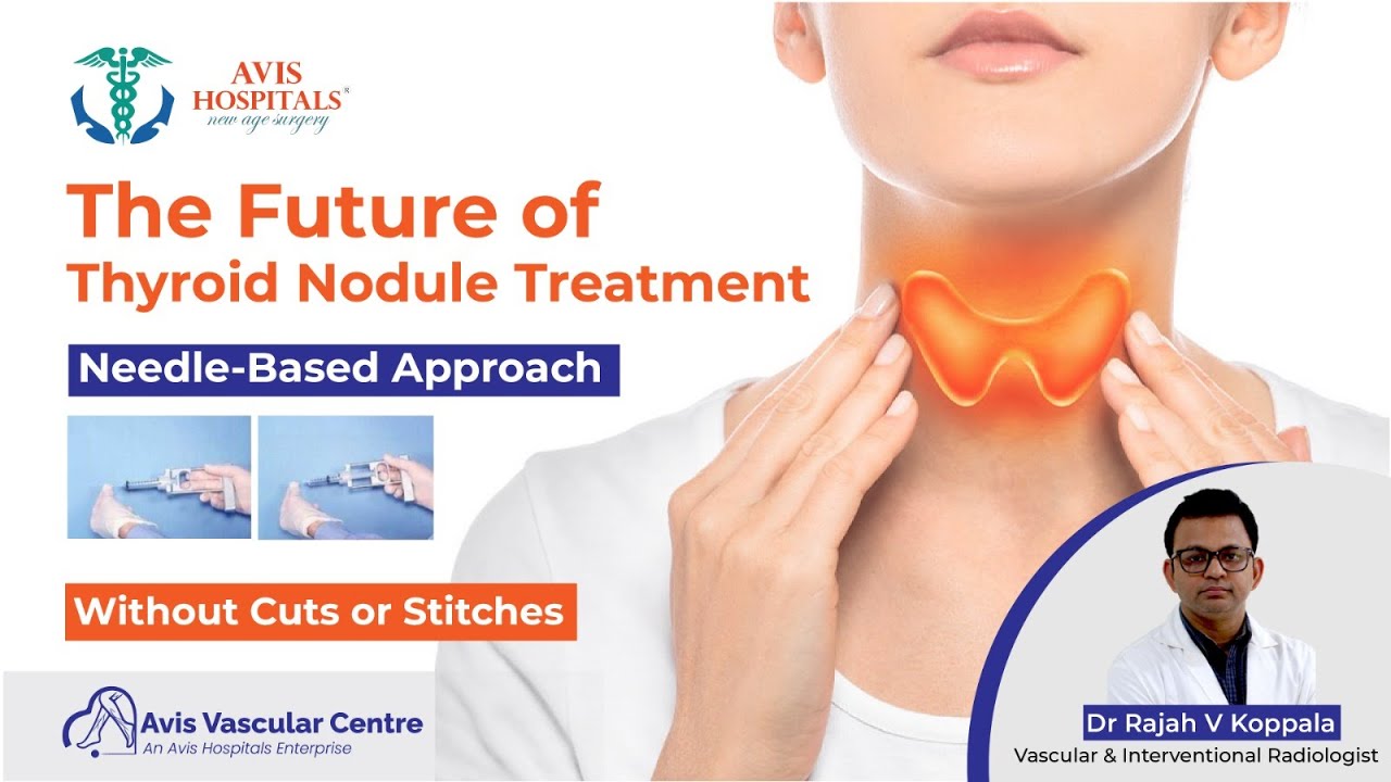 The Future of Thyroid Nodule Treatment | Needle-Based Approach Without Cuts or Stitches