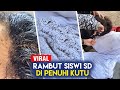 VIRAL RAMBUT SISWA SD DI PENUHI KUTU - SIDUL TUBE