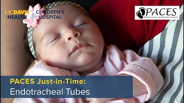 PACES Just-in-Time: Endotracheal Intubation