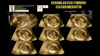 Kehamilan 17 minggu pemeriksaan rutin
